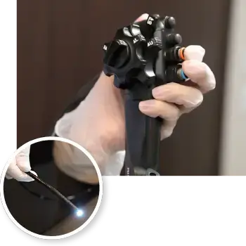 つらくない大腸カメラの検査のための極細内視鏡カメラ